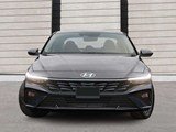 2026 Hyundai Elantra Preferred image 2